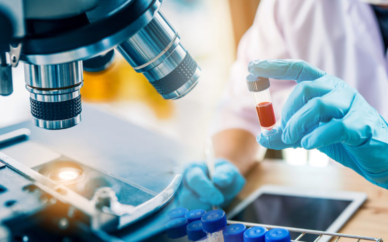 lab technician assistant analyzing a blood sample in test tube at laboratory with microscope. Medical, pharmaceutical and scientific research and development concept.