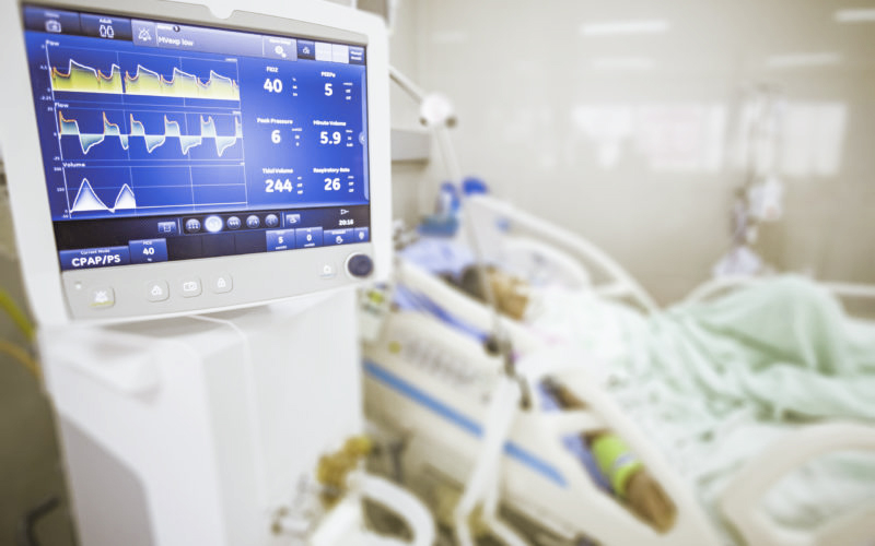 Ventilator monitor ,given oxygen by intubation tube to patient, setting in ICU/Emergency room